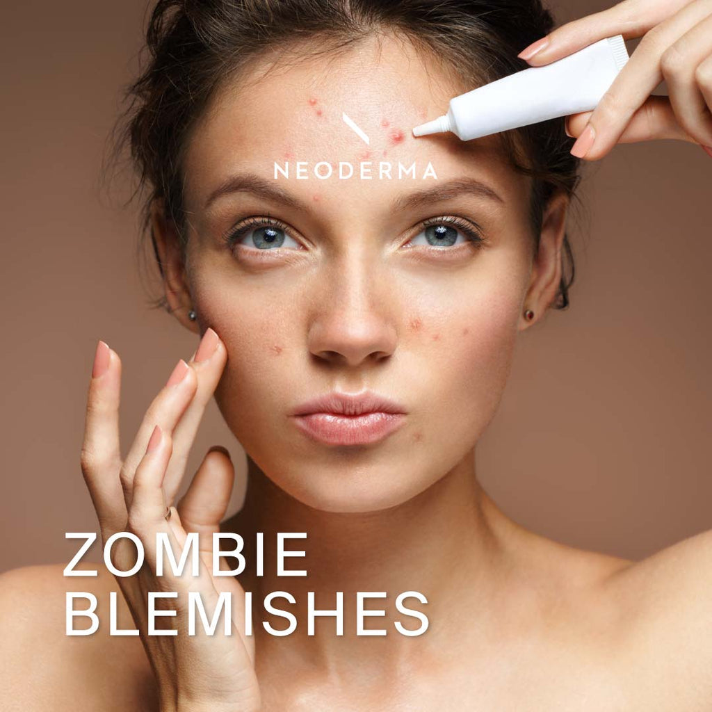 Zombie Blemishes